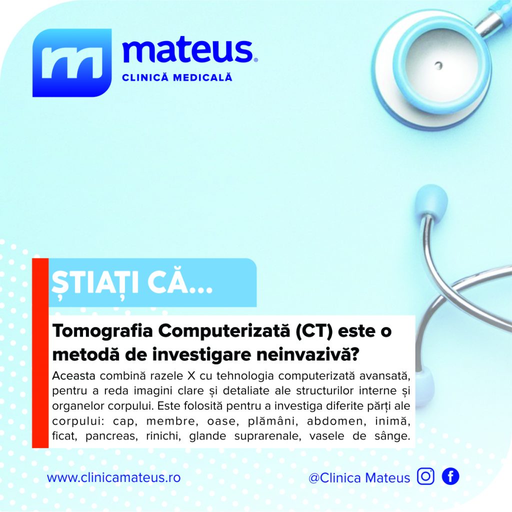 Informatii de tip Stiati ca...despre Computerul Tomograf (CT)
